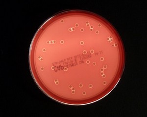 plate with colonies of staphylococcus aureus, beta-hemolysis